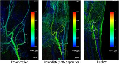 How to create a nervous system aneurysm model in canines? ligation of the lingual artery is a simple and effective method